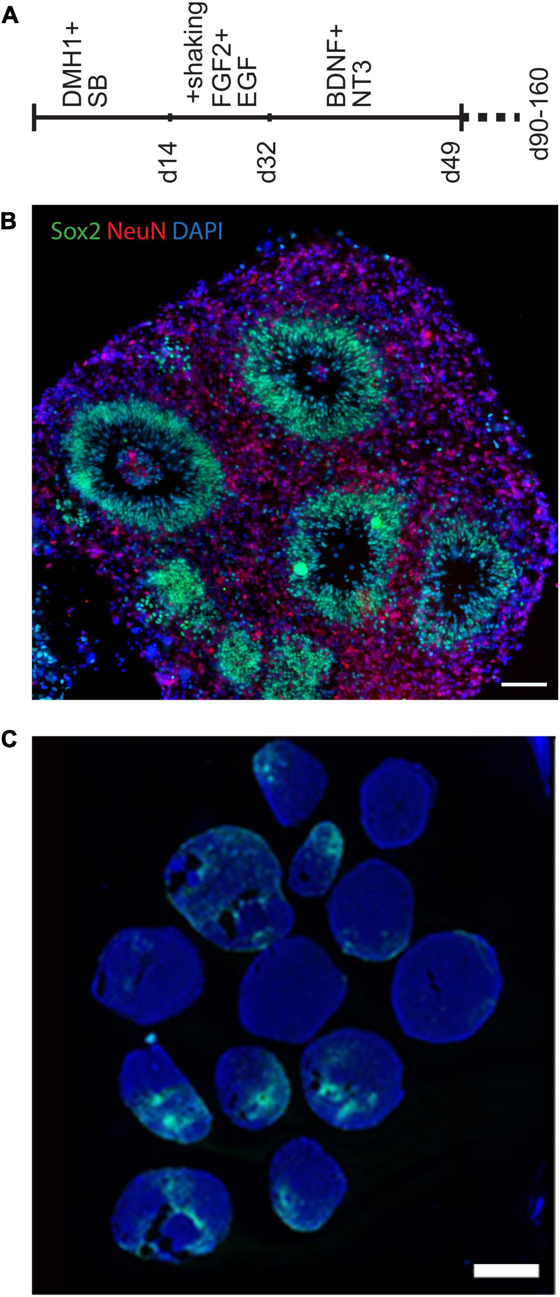 Large-scale organoid study suggests effects of trisomy 21 on early fetal neurodevelopment are more subtle than variability between isogenic lines and experiments